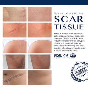 T&H Scar Remover Gel For Scars From C-Section, Stretch Marks, Acne, Surgery