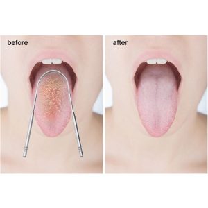 2Packs Tongue Scraper Cleaner Reusable Stainless Steel