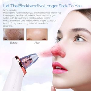 5 In 1 Blackhead Black Head Remover Vacuum Suction Cleaner