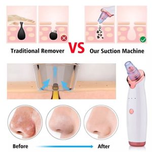 5 In 1 Blackhead Black Head Remover Vacuum Suction Cleaner