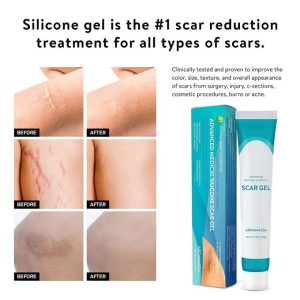 Aroamas Scar Advanced Scar Removal Gel, Scar Removal Cream, Medical Grade Silicone Scar Gel