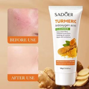 SADOER 8 Pieces Set Tumeric moisturizing and skin glowing Skin Care Set: Turmeric Face Cream + Serum + 5 Face Masks + Face Cleanser For Treating...