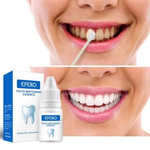 Teeth Whitener Teeth Whitening Yellow Teeth Stains Remover Teeth Whitener