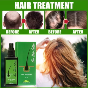 NEO HAIR LOTION