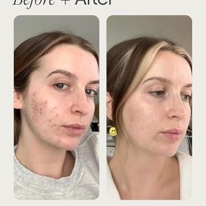 Topicals Faded Brightening and Clearing Serum