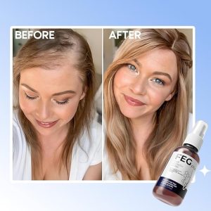 fegplus Hair and Beard Growth Serum