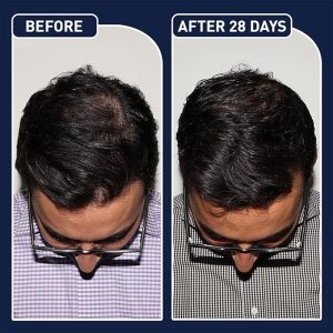 fegplus Hair and Beard Growth Serum