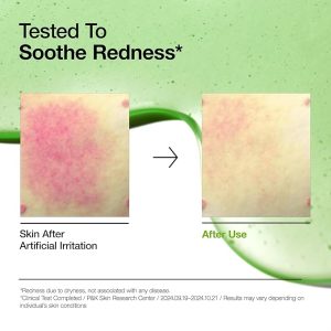 Anua Azelaic Acid 10 Hyaluron Redness Soothing Serum, Facial Serum for Sensitive skin