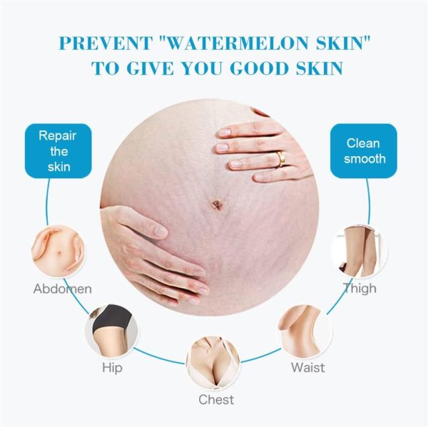 Stretch Marks Fading Cream Maternity Scars Acne Cream Pregnancy Stretch Marks Remove Cream Repair Anti-Aging Winkle Firmng Body Cream (3 PCS) - Image 3