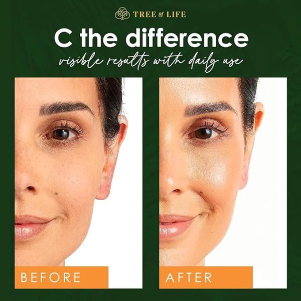 Vitamin C Serum for Face - Anti Aging Facial Serum - Image 6